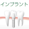 インプラント